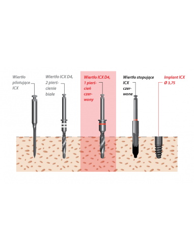 procedura chirurgiczna