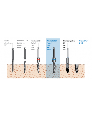 Procedura chirurgiczna