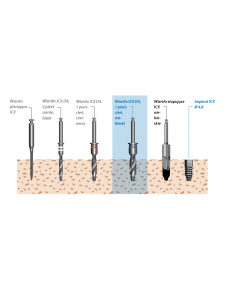 Procedura chirurgiczna