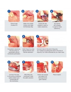 Surgident Master Piece 20 2