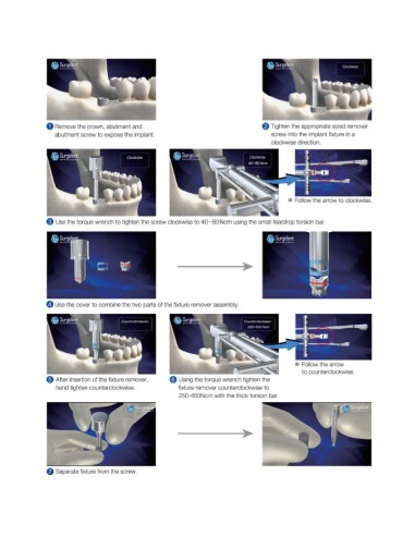 Surgident Single Out