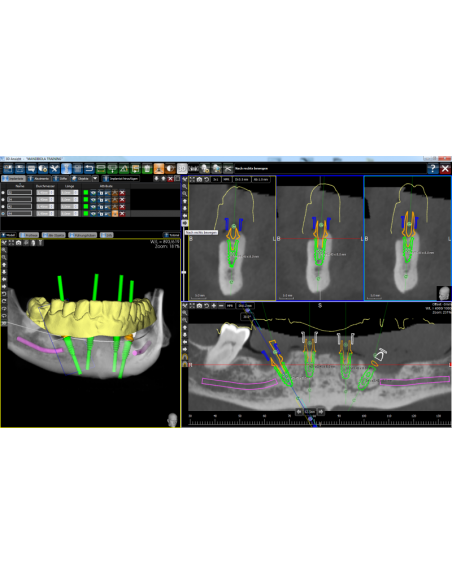 ICX-Magellan punch do śluzówki Ø3.45mm, Ø3.75mm, Ø4.1mm, Ø4.8mm