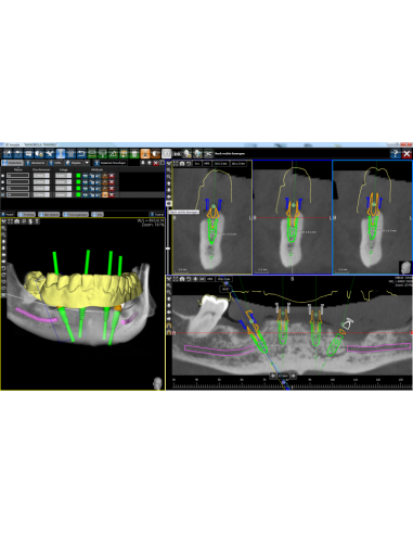 ICX-Magellan przenośnik z żółtym...